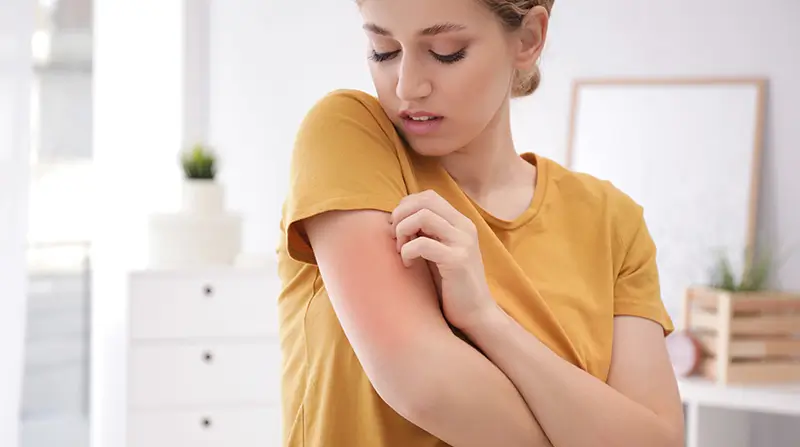 Pani drapiąca się po ramieniu