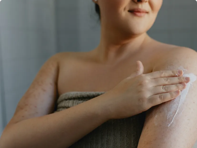A close-up of a womans arm displaying signs of dryness and applying a bit of cream.