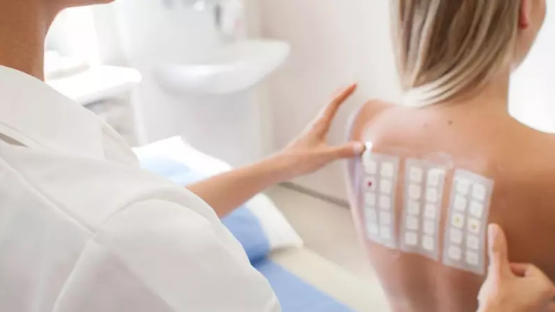 Hogyan kezeljem az allergiát?